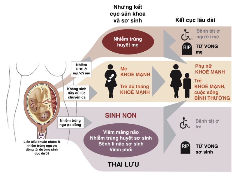 Ảnh hưởng của GBS lên thai kì